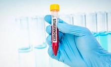 COVID-19 zasahuje seniorov v Košiciach: Päť hospitalizovaných