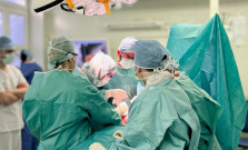 Prešovskí ortopédi spustili unikátnu liečbu chronických rán, ktorá môže zabrániť amputáciám