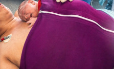 Bardejovská nemocnica ako prvá na Slovensku zaviedla dvojhodinový bonding po cisárskom reze