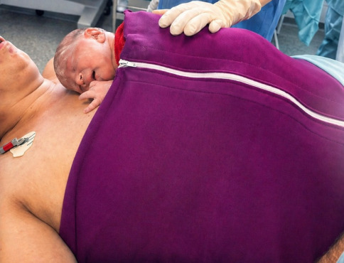 Bardejovská nemocnica ako prvá na Slovensku zaviedla dvojhodinový bonding po cisárskom reze